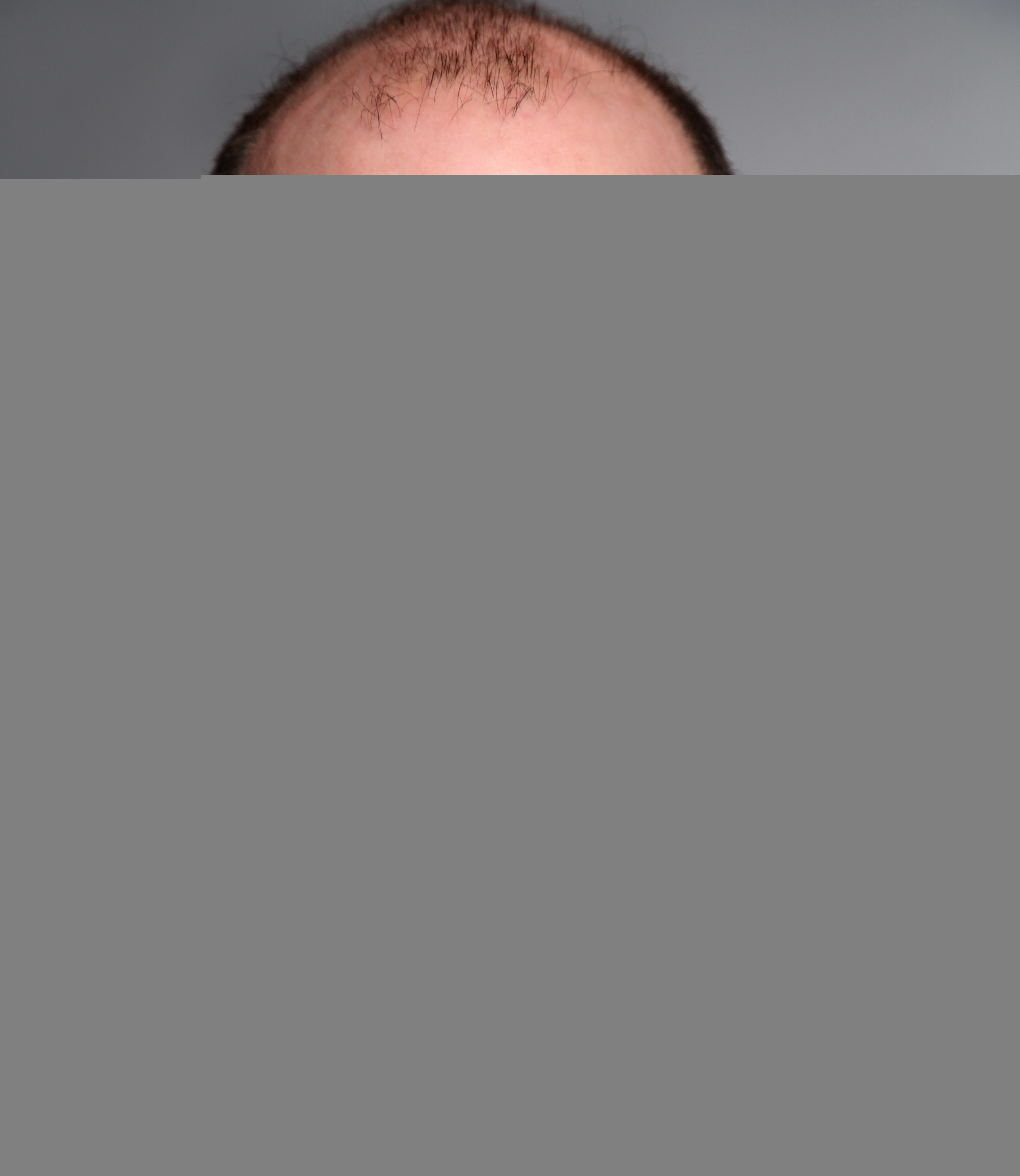 Eric_Friedman