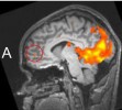 Your Brain on Drug Addicts - Thumbnail